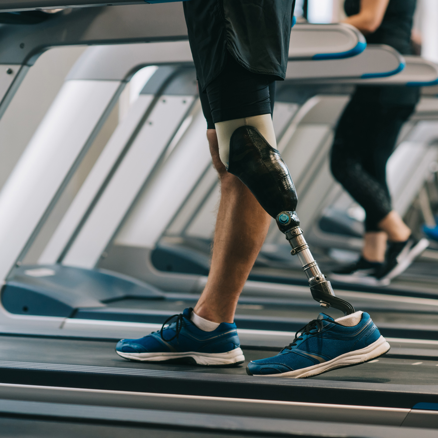 Person with a prosthetic leg on a treadmill